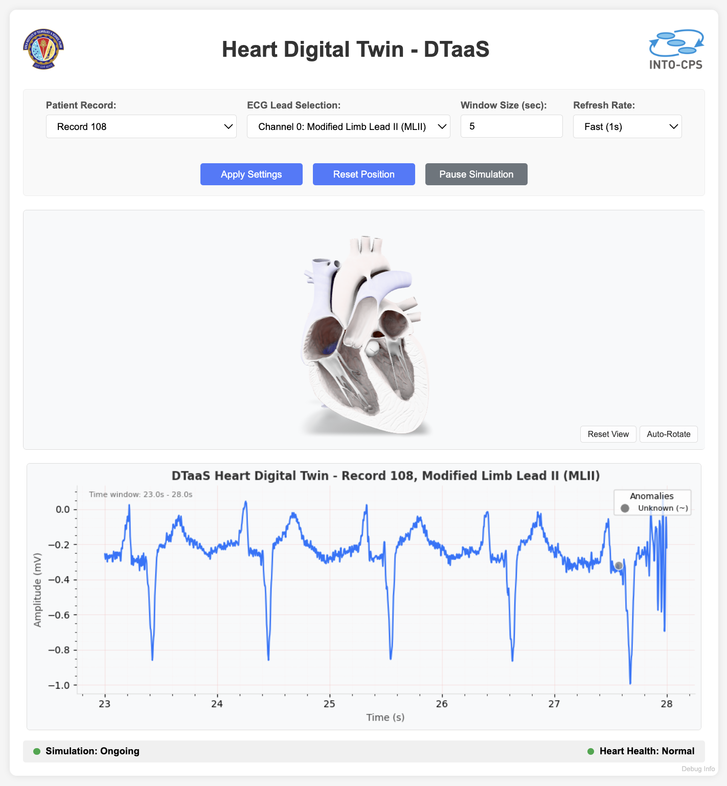 Heart Digital Twin Web Interface